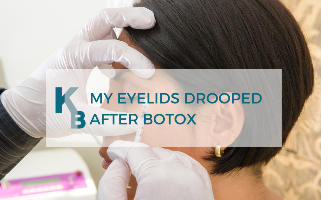 Droopy Eyelid After Botox | Essence Medical Cosmetic Clinic