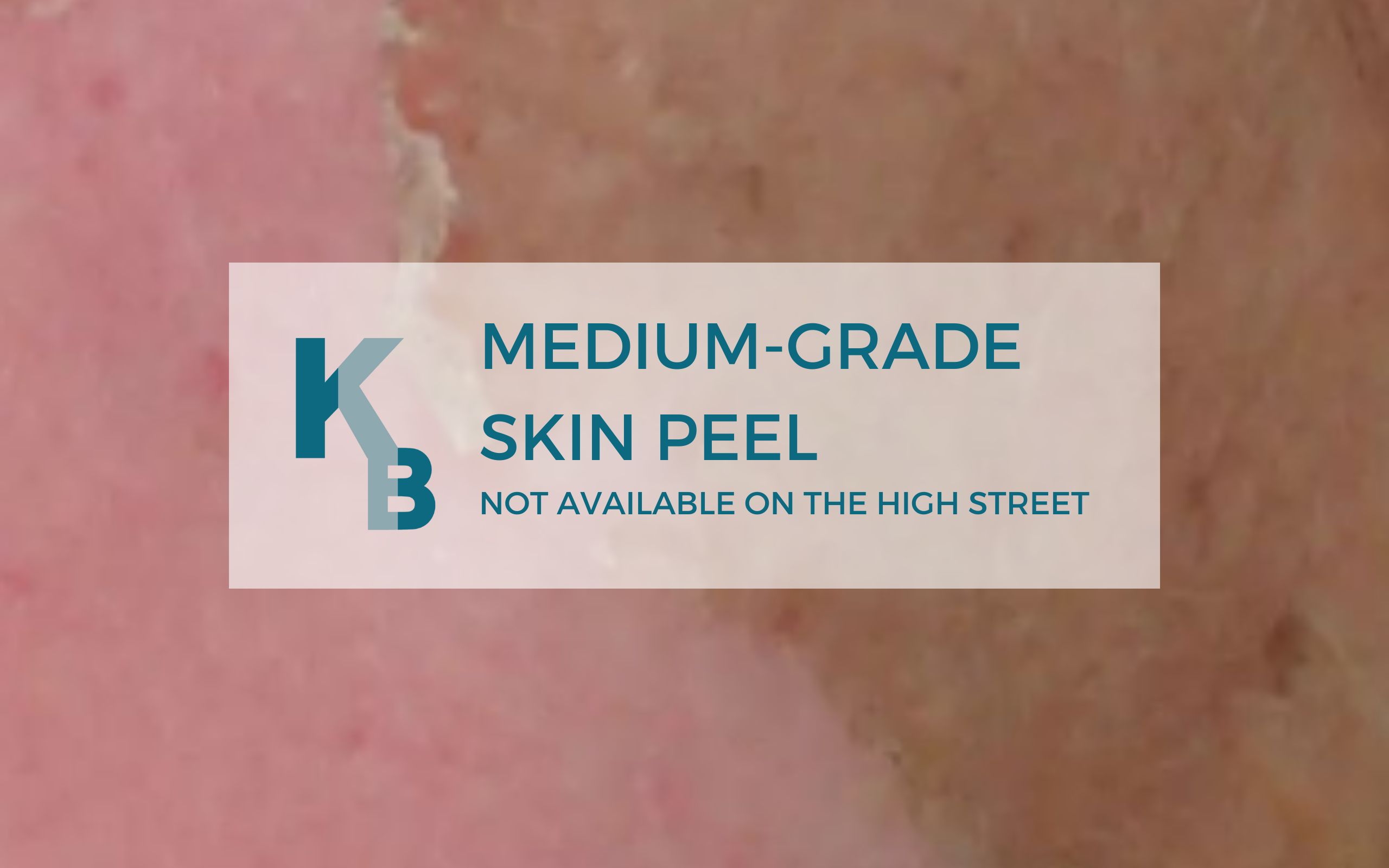 MEDIUM GRADE SKIN PEEL