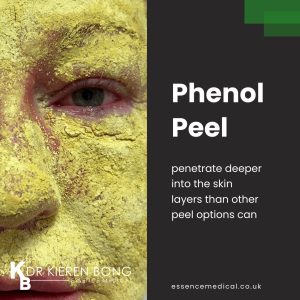 Phenol Face Peel