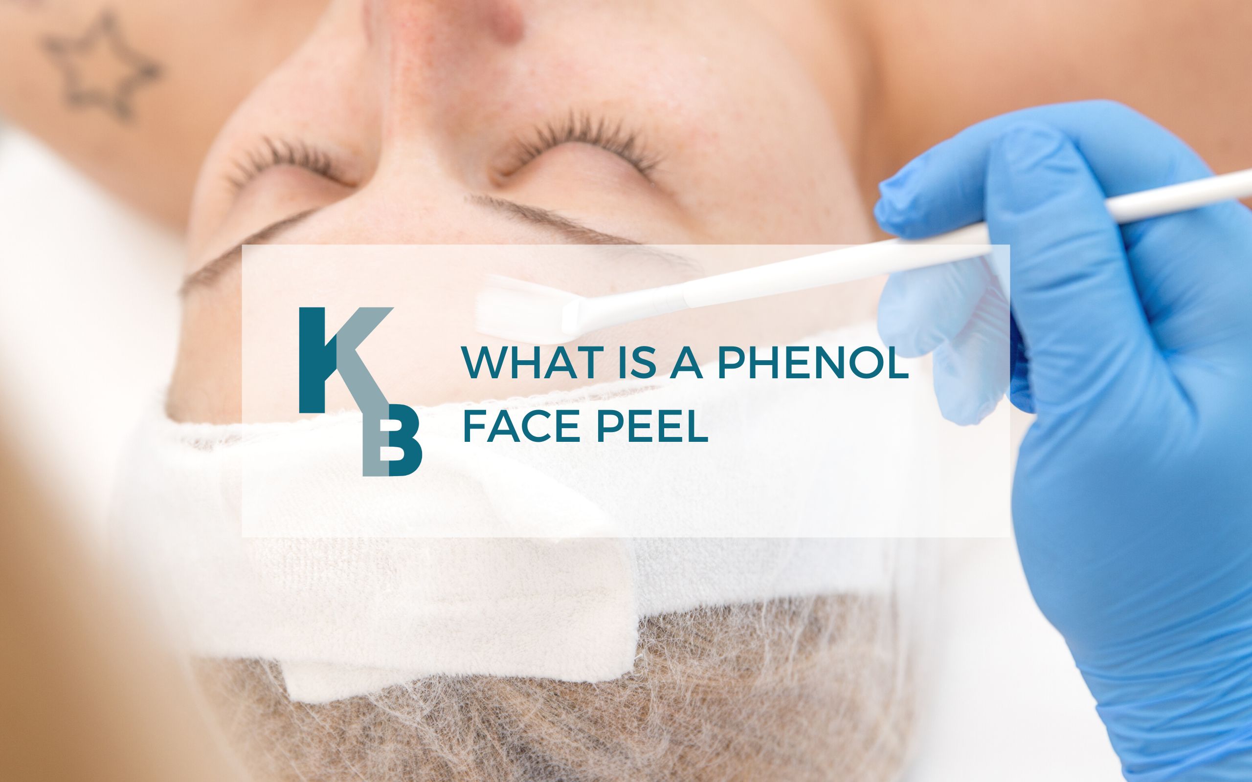 What is a Phenol Face Peel