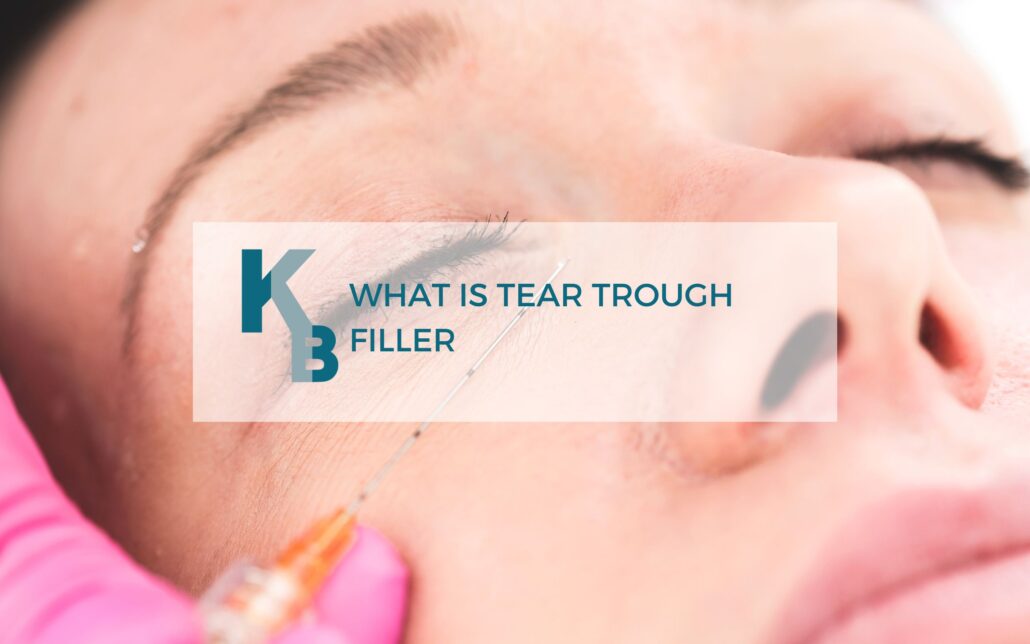 What Is Tear Trough Filler Essence Medical Cosmetic Clinic   What Is Tear Trough Filler Blog 1030x644 