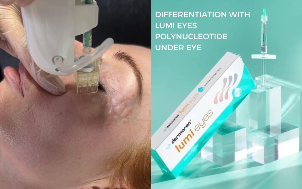 Differentiation With Lumi Eyes Polynucleotide Under Eyes blog